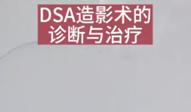 DSA造影術的診斷與治療