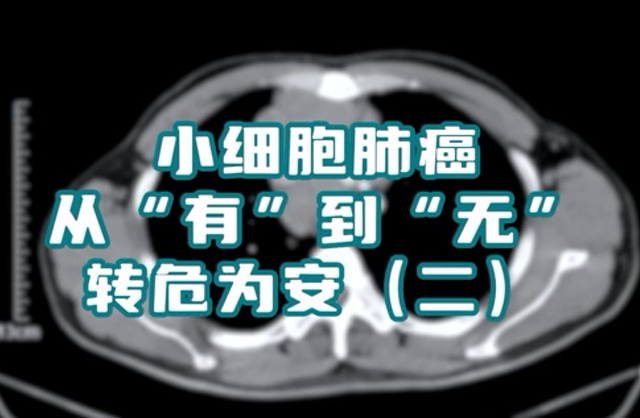 小細(xì)胞肺癌患者，縱隔淋巴結(jié)腫大，情況危急。通過(guò)介入綜合治療，病灶已基本消失